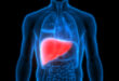 A balanced approach to weight loss with liver issues