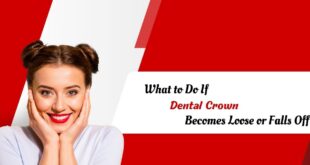 What-to-Do-If-Dental-Crown-Becomes-Loose-or-Falls-Off