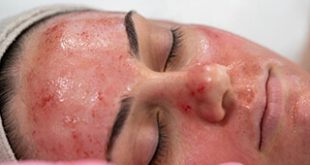 best skin specialist in lahore